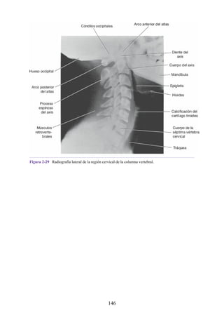 Figura 2-29 Radiografía lateral de la región cervical de la columna vertebral.
146
 
