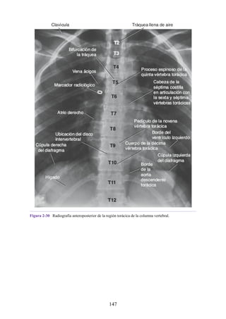 Figura 2-30 Radiografía anteroposterior de la región torácica de la columna vertebral.
147
 