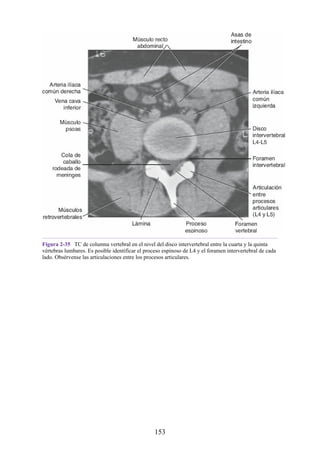 Figura 2-35 TC de columna vertebral en el nivel del disco intervertebral entre la cuarta y la quinta
vértebras lumbares. Es posible identificar el proceso espinoso de L4 y el foramen intervertebral de cada
lado. Obsérvense las articulaciones entre los procesos articulares.
153
 