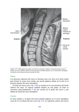 Figura 2-36 RM sagital de la región cervical de la columna vertebral. Una hernia de disco entre la
quinta y la sexta vértebras. Obsérvese la posición de la médula espinal y sus revestimientos meníngeos
en relación con la hernia de disco (cortesía de: Pait).
Sacro
Los procesos espinosos del sacro se fusionan unos con otros en la línea media
para formar la cresta sacra media, que puede palparse debajo de la piel en la
porción superior del surco interglúteo.
El hiato del sacro (véase fig. 2-26) se localiza en la cara posterior del borde
inferior del sacro. El espacio epidural finaliza en este punto. El hiato se
encuentra aproximadamente 5 cm por encima de la punta del cóccix y por
debajo de la piel del surco interglúteo.
Cóccix
El surco inferior y la punta del cóccix pueden palparse en el surco interglúteo
cerca de 2,5 cm detrás del ano (véase fig. 2-1). La superficie anterior del cóccix
154
 