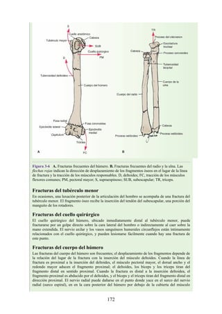Figura 3-6 A. Fracturas frecuentes del húmero. B. Fracturas frecuentes del radio y la ulna. Las
flechas rojas indican la dirección de desplazamiento de los fragmentos óseos en el lugar de la línea
de fractura y la tracción de los músculos responsables. D, deltoides; FC, tracción de los músculos
flexores comunes; PM, pectoral mayor; S, supraespinoso; SUB, subescapular; TR, tríceps.
Fracturas del tubérculo menor
En ocasiones, una luxación posterior de la articulación del hombro se acompaña de una fractura del
tubérculo menor. El fragmento óseo recibe la inserción del tendón del subescapular, una porción del
manguito de los rotadores.
Fracturas del cuello quirúrgico
El cuello quirúrgico del húmero, ubicado inmediatamente distal al tubérculo menor, puede
fracturarse por un golpe directo sobre la cara lateral del hombro o indirectamente al caer sobre la
mano extendida. El nervio axilar y los vasos sanguíneos humerales circunflejos están íntimamente
relacionados con el cuello quirúrgico, y pueden lesionarse fácilmente cuando hay una fractura de
este punto.
Fracturas del cuerpo del húmero
Las fracturas del cuerpo del húmero son frecuentes; el desplazamiento de los fragmentos depende de
la relación del lugar de la fractura con la inserción del músculo deltoides. Cuando la línea de
fractura es proximal a la inserción del deltoides, el músculo pectoral mayor, el dorsal ancho y el
redondo mayor aducen el fragmento proximal; el deltoides, los bíceps y los tríceps tiran del
fragmento distal en sentido proximal. Cuando la fractura es distal a la inserción deltoidea, el
fragmento proximal es abducido por el deltoides, y el bíceps y el tríceps tiran del fragmento distal en
dirección proximal. El nervio radial puede dañarse en el punto donde yace en el surco del nervio
radial (surco espiral), en en la cara posterior del húmero por debajo de la cubierta del músculo
172
 