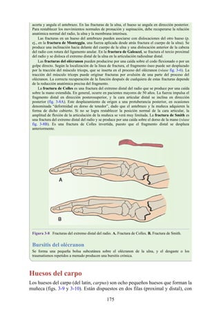 acorta y angula el antebrazo. En las fracturas de la ulna, el hueso se angula en dirección posterior.
Para restablecer los movimientos normales de pronación y supinación, debe recuperarse la relación
anatómica normal del radio, la ulna y la membrana interósea.
Las fracturas en un hueso del antebrazo pueden asociarse con dislocaciones del otro hueso (p.
ej., en la fractura de Monteggia, una fuerza aplicada desde atrás fractura el cuerpo de la ulna). Se
produce una inclinación hacia delante del cuerpo de la ulna y una dislocación anterior de la cabeza
del radio con rotura del ligamento anular. En la fractura de Galeazzi, se fractura el tercio proximal
del radio y se disloca el extremo distal de la ulna en la articulación radioulnar distal.
Las fracturas del olécranon pueden producirse por una caída sobre el codo flexionado o por un
golpe directo. Según la localización de la línea de fractura, el fragmento óseo puede ser desplazado
por la tracción del músculo tríceps, que se inserta en el proceso del olécranon (véase fig. 3-6). La
tracción del músculo tríceps puede originar fracturas por avulsión de una parte del proceso del
olécranon. La correcta recuperación de la función después de cualquiera de estas fracturas depende
de la reducción anatómica precisa del fragmento.
La fractura de Colles es una fractura del extremo distal del radio que se produce por una caída
sobre la mano extendida. En general, ocurre en pacientes mayores de 50 años. La fuerza impulsa el
fragmento distal en dirección posterosuperior, y la cara articular distal se inclina en dirección
posterior (fig. 3-8A). Este desplazamiento da origen a una protuberancia posterior, en ocasiones
denominada “deformidad en dorso de tenedor”, dado que el antebrazo y la muñeca adquieren la
forma de dicho cubierto. Si no se logra restablecer la posición normal de la cara articular, la
amplitud de flexión de la articulación de la muñeca se verá muy limitada. La fractura de Smith es
una fractura del extremo distal del radio y se produce por una caída sobre el dorso de la mano (véase
fig. 3-8B). Es una fractura de Colles invertida, puesto que el fragmento distal se desplaza
anteriormente.
Figura 3-8 Fracturas del extremo distal del radio. A. Fractura de Colles. B. Fractura de Smith.
Bursitis del olécranon
Se forma una pequeña bolsa subcutánea sobre el olécranon de la ulna, y el desgaste o los
traumatismos repetidos a menudo producen una bursitis crónica.
Huesos del carpo
Los huesos del carpo (del latin, carpus) son ocho pequeños huesos que forman la
muñeca (figs. 3-9 y 3-10). Están dispuestos en dos filas (proximal y distal), con
175
 