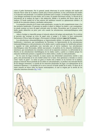 cierre el puño fuertemente. Por lo general, puede observarse la acción sinérgica del tendón del
músculo flexor ulnar de la muñeca cuando pasa al hueso pisiforme; no hay estiramiento del tendón
si el músculo está paralizado. Los tendones profundos para el anular y el meñique no tienen función,
y las falanges terminales de estos dedos, por lo tanto, no pueden flexionarse mucho. La flexión de la
articulación de la muñeca da lugar a una abducción, debido a la parálisis del flexor ulnar de la
muñeca. El borde medial de la cara anterior del antebrazo muestra un aplanamiento debido a la
atrofia de los músculos ulnares y profundos subyacentes.
Los pequeños músculos de la mano están paralizados, excepto los del compartimento tenar y los
dos primeros lumbricales. El paciente no puede ni aducir ni abducir los dedos y, por consiguiente,
no puede sostener un trozo de papel colocado entre los dedos. Recuérdese que el extensor de los
dedos puede abducirlos un poco, pero solo cuando las articulaciones metacarpofalángicas están
extendidas.
Aducir el pulgar es imposible porque el músculo aductor del pulgar está paralizado. Si se solicita
al paciente que sostenga un trozo de papel entre el pulgar y el índice, lo hace contrayendo
fuertemente el flexor largo del pulgar y flexionando la falange terminal (signo de Froment).
Las articulaciones metacarpofalángicas se hiperextienden debido a la parálisis de los músculos
lumbricales e interóseos, que normalmente las flexionan. La hiperextensión de las articulaciones
metacarpofalángicas es más prominente en los dedos cuarto y quinto porque los lumbricales primero
y segundo no están paralizados (son inervados por el nervio mediano). Las articulaciones
interfalángicas están flexionadas, debido nuevamente a la parálisis de los músculos lumbricales e
interóseos, que normalmente las extienden a través de la expansión extensora. La deformidad de la
flexión en las articulaciones interfalángicas de los dedos cuarto y quinto es evidente porque los
músculos lumbricales primero y segundo de los dedos índice y medio no están paralizados.
En los casos de larga evolución, la mano asume una deformidad característica similar a una
garra, más pronunciada en la cara medial (ulnar) de la mano. Esta apariencia a menudo se conoce
como “mano en garra”. La mano en garra es mucho más evidente en las lesiones de la muñeca,
porque el músculo flexor profundo de los dedos no está paralizado y se produce una marcada flexión
de las falanges terminales. La atrofia de los músculos paralizados da lugar a un aplanamiento de la
eminencia hipotenar y a la pérdida de la curva convexa al borde medial de la mano. El dorso de la
mano muestra un hueco entre los huesos metacarpianos, el cual se origina por la atrofia de los
músculos interóseos dorsales (fig. 3-62).
272
 