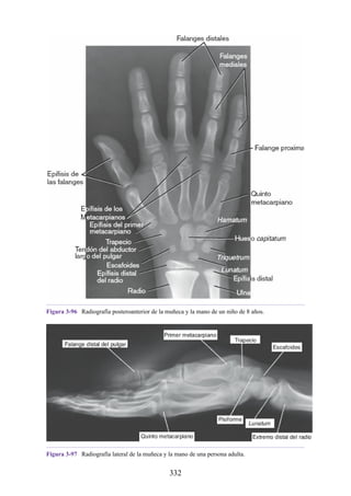 Figura 3-96 Radiografía posteroanterior de la muñeca y la mano de un niño de 8 años.
Figura 3-97 Radiografía lateral de la muñeca y la mano de una persona adulta.
332
 