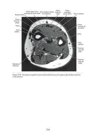 Figura 3-99 Resonancia magnética transversal (axial) de la porción superior del antebrazo derecho
(vista inferior).
334
 