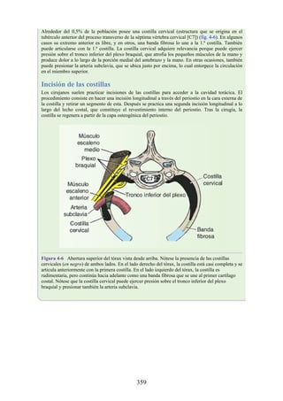 Alrededor del 0,5% de la población posee una costilla cervical (estructura que se origina en el
tubérculo anterior del proceso transverso de la séptima vértebra cervical [C7]) (fig. 4-6). En algunos
casos su extremo anterior es libre, y en otros, una banda fibrosa lo une a la 1.ª costilla. También
puede articularse con la 1.ª costilla. La costilla cervical adquiere relevancia porque puede ejercer
presión sobre el tronco inferior del plexo braquial, que atrofia los pequeños músculos de la mano y
produce dolor a lo largo de la porción medial del antebrazo y la mano. En otras ocasiones, también
puede presionar la arteria subclavia, que se ubica justo por encima, lo cual entorpece la circulación
en el miembro superior.
Incisión de las costillas
Los cirujanos suelen practicar incisiones de las costillas para acceder a la cavidad torácica. El
procedimiento consiste en hacer una incisión longitudinal a través del periostio en la cara externa de
la costilla y retirar un segmento de esta. Después se practica una segunda incisión longitudinal a lo
largo del lecho costal, que constituye el revestimiento interno del periostio. Tras la cirugía, la
costilla se regenera a partir de la capa osteogénica del periostio.
Figura 4-6 Abertura superior del tórax vista desde arriba. Nótese la presencia de las costillas
cervicales (en negro) de ambos lados. En el lado derecho del tórax, la costilla está casi completa y se
articula anteriormente con la primera costilla. En el lado izquierdo del tórax, la costilla es
rudimentaria, pero continúa hacia adelante como una banda fibrosa que se une al primer cartílago
costal. Nótese que la costilla cervical puede ejercer presión sobre el tronco inferior del plexo
braquial y presionar también la arteria subclavia.
359
 