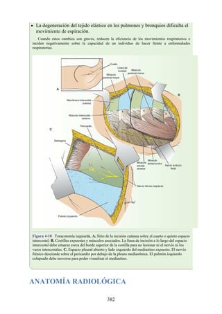 La degeneración del tejido elástico en los pulmones y bronquios dificulta el
movimiento de espiración.
Cuando estos cambios son graves, reducen la eficiencia de los movimientos respiratorios e
inciden negativamente sobre la capacidad de un individuo de hacer frente a enfermedades
respiratorias.
Figura 4-18 Toracotomía izquierda. A. Sitio de la incisión cutánea sobre el cuarto o quinto espacio
intercostal. B. Costillas expuestas y músculos asociados. La línea de incisión a lo largo del espacio
intercostal debe situarse cerca del borde superior de la costilla para no lesionar ni el nervio ni los
vasos intercostales. C. Espacio pleural abierto y lado izquierdo del mediastino expuesto. El nervio
frénico desciende sobre el pericardio por debajo de la pleura mediastínica. El pulmón izquierdo
colapsado debe moverse para poder visualizar el mediastino.
ANATOMÍA RADIOLÓGICA
382
 