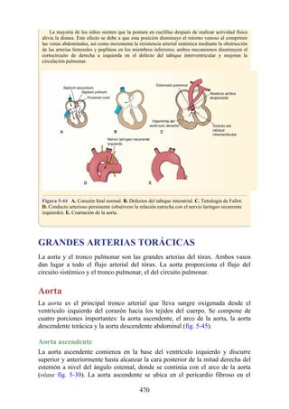 La mayoría de los niños sienten que la postura en cuclillas después de realizar actividad física
alivia la disnea. Este efecto se debe a que esta posición disminuye el retorno venoso al comprimir
las venas abdominales, así como incrementa la resistencia arterial sistémica mediante la obstrucción
de las arterias femorales y poplíteas en los miembros inferiores; ambos mecanismos disminuyen el
cortocircuito de derecha a izquierda en el defecto del tabique interventricular y mejoran la
circulación pulmonar.
Figura 5-44 A. Corazón fetal normal. B. Defectos del tabique interatrial. C. Tetralogía de Fallot.
D. Conducto arterioso persistente (obsérvese la relación estrecha con el nervio laríngeo recurrente
izquierdo). E. Coartación de la aorta.
GRANDES ARTERIAS TORÁCICAS
La aorta y el tronco pulmonar son las grandes arterias del tórax. Ambos vasos
dan lugar a todo el flujo arterial del tórax. La aorta proporciona el flujo del
circuito sistémico y el tronco pulmonar, el del circuito pulmonar.
Aorta
La aorta es el principal tronco arterial que lleva sangre oxigenada desde el
ventrículo izquierdo del corazón hacia los tejidos del cuerpo. Se compone de
cuatro porciones importantes: la aorta ascendente, el arco de la aorta, la aorta
descendente torácica y la aorta descendente abdominal (fig. 5-45).
Aorta ascendente
La aorta ascendente comienza en la base del ventrículo izquierdo y discurre
superior y anteriormente hasta alcanzar la cara posterior de la mitad derecha del
esternón a nivel del ángulo esternal, donde se continúa con el arco de la aorta
(véase fig. 5-30). La aorta ascendente se ubica en el pericardio fibroso en el
470
 