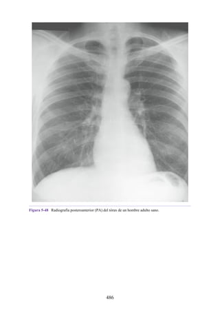 Figura 5-48 Radiografía posteroanterior (PA) del tórax de un hombre adulto sano.
486
 