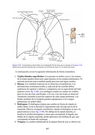 Figura 5-49 Características observables en la radiografía PA de tórax que se muestra en la figura 5-48.
Obsérvese la posición del paciente en relación con la fuente de rayos X y el chasis del casete.
A continuación, revise la siguiente información de forma sistemática:
1. Tejidos blandos superficiales. Los pezones en ambos sexos y las mamas
de la mujer pueden observarse super-puestos en los campos pulmonares. El
músculo pectoral mayor también puede provocar una ligera sombra.
2. Huesos. Las vértebras torácicas no se observan a la perfección. Las
articulaciones costotransversales y cada una de las costillas deben
explorarse de superior a inferior y compararse con su equivalente del lado
opuesto (véase fig. 5-48). Los cartílagos costales no suelen ser visibles,
pero en caso de estar calcificados, sí lo son. Las clavículas se observan
claramente cruzando la porción superior de cada campo pulmonar. Los
bordes mediales de la escápula pueden superponerse a los campos
pulmonares en ambos lados.
3. Diafragma. El diafragma origina una sombra en forma de cúpula en
ambos lados; la de la derecha es ligeramente más elevada que la de la
izquierda. Observe el ángulo costofrénico, donde el diafragma se une a la
pared torácica (véase fig. 5-48). Por debajo de la cúpula derecha, se
localiza la sombra homogénea y densa que corresponde al hígado; por
debajo de la cúpula izquierda, puede apreciarse una burbuja de gas, que
corresponde al fondo del estómago.
4. Tráquea. La sombra radiolúcida de la tráquea llena de aire se observa en
487
 