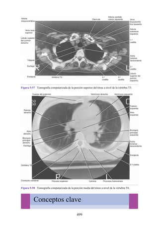 Figura 5-57 Tomografía computarizada de la porción superior del tórax a nivel de la vértebra T3.
Figura 5-58 Tomografía computarizada de la porción media del tórax a nivel de la vértebra T6.
Conceptos clave
499
 