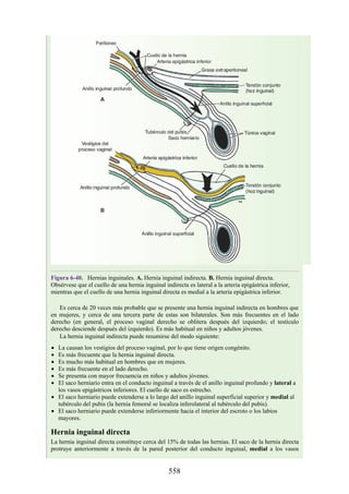 Figura 6-40. Hernias inguinales. A. Hernia inguinal indirecta. B. Hernia inguinal directa.
Obsérvese que el cuello de una hernia inguinal indirecta es lateral a la arteria epigástrica inferior,
mientras que el cuello de una hernia inguinal directa es medial a la arteria epigástrica inferior.
Es cerca de 20 veces más probable que se presente una hernia inguinal indirecta en hombres que
en mujeres, y cerca de una tercera parte de estas son bilaterales. Son más frecuentes en el lado
derecho (en general, el proceso vaginal derecho se oblitera después del izquierdo; el testículo
derecho desciende después del izquierdo). Es más habitual en niños y adultos jóvenes.
La hernia inguinal indirecta puede resumirse del modo siguiente:
La causan los vestigios del proceso vaginal, por lo que tiene origen congénito.
Es más frecuente que la hernia inguinal directa.
Es mucho más habitual en hombres que en mujeres.
Es más frecuente en el lado derecho.
Se presenta con mayor frecuencia en niños y adultos jóvenes.
El saco herniario entra en el conducto inguinal a través de el anillo inguinal profundo y lateral a
los vasos epigástricos inferiores. El cuello de saco es estrecho.
El saco herniario puede extenderse a lo largo del anillo inguinal superficial superior y medial al
tubérculo del pubis (la hernia femoral se localiza inferolateral al tubérculo del pubis).
El saco herniario puede extenderse inferiormente hacia el interior del escroto o los labios
mayores.
Hernia inguinal directa
La hernia inguinal directa constituye cerca del 15% de todas las hernias. El saco de la hernia directa
protruye anteriormente a través de la pared posterior del conducto inguinal, medial a los vasos
558
 