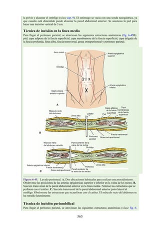 la pelvis y alcanzar el ombligo (véase cap. 9). El estómago se vacía con una sonda nasogástrica, ya
que cuando está distendido puede alcanzar la pared abdominal anterior. Se anestesia la piel para
hacer una incisión vertical de 3 cm.
Técnica de incisión en la línea media
Para llegar al peritoneo parietal, se atraviesan las siguientes estructuras anatómicas (fig. 6-45B):
piel, capa adiposa de la fascia superficial, capa membranosa de la fascia superficial, capa delgada de
la fascia profunda, línea alba, fascia transversal, grasa extraperitoneal y peritoneo parietal.
Figura 6-45. Lavado peritoneal. A. Dos ubicaciones habituales para realizar este procedimiento.
Obsérvense las posiciones de las arterias epigástricas superior e inferior en la vaina de los rectos. B.
Sección transversal de la pared abdominal anterior en la línea media. Nótense las estructuras que se
perforan con el catéter. C. Sección transversal de la pared abdominal anterior justo lateral al
ombligo. Obsérvense las estructuras que se perforan con el catéter. El músculo recto del abdomen se
ha retraído lateralmente.
Técnica de incisión periumbilical
Para llegar al peritoneo parietal, se atraviesan las siguientes estructuras anatómicas (véase fig. 6-
565
 