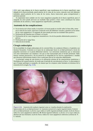 45C): piel, capa adiposa de la fascia superficial, capa membranosa de la fascia superficial, capa
delgada de la fascia profunda, pared anterior de la vaina de los rectos, músculo recto del abdomen
(retraído), pared posterior de la vaina de los rectos, fascia transversal, grasa extraperitoneal y
peritoneo parietal.
Es importante tener cuidado con los vasos sanguíneos pequeños de la fascia superficial, pues el
sangrado de estos puede provocar un resultado falso positivo. Estos vasos constituyen las ramas
terminales de las arterias y venas epigástricas superficiales y profundas.
Anatomía de las complicaciones
En la técnica de la línea media, la incisión o el trocar puede no incidir sobre la línea alba, entrar
en la vaina de los rectos, atravesar el músculo recto del abdomen vascular y penetrar en las ramas
de los vasos epigástricos. El sangrado de estos puede provocar un resultado falso positivo.
Perforación del intestino por el bisturí o el trocar.
Perforación de los vasos sanguíneos mesentéricos o los de las paredes abdominales posterior o
pélvica.
Perforación de la vejiga llena.
Infección de la herida.
Cirugía endoscópica
En la actualidad, la cirugía endoscópica de la vesícula biliar, los conductos biliares y el apéndice son
técnicas frecuentes. Consisten en el paso de un endoscopio hacia la cavidad peritoneal a través de
pequeñas incisiones en la pared abdominal anterior. Las estructuras anatómicas que se atraviesan
con estos instrumentos son similares a las que se han mencionado para el lavado peritoneal. Debe
tenerse extrema precaución a fin de preservar la integridad de los nervios segmentarios a medida
que discurren inferiormente desde el arco costal para inervar los músculos abdominales.
La principal ventaja de esta técnica es la afectación mínima de las características anatómicas y
fisiológicas de la pared anterior, de modo que el período de convalecencia es breve. La desventaja es
que el campo quirúrgico es pequeño, de manera que los cirujanos están limitados en términos de la
extensión de la cirugía (fig. 6-46).
Figura 6-46. Anatomía del conducto inguinal como se visualiza durante la exploración
laparoscópica de la cavidad peritoneal. A. Anatomía normal de la región inguinal desde el interior
de la cavidad peritoneal. La flecha negra indica el anillo inguinal profundo cerrado; la flecha blanca
indica los vasos epigástricos inferiores. B. Hernia inguinal indirecta. La flecha curva negra indica la
abertura del saco herniario; la flecha blanca indica los vasos epigástricos inferiores (cortesía de: N.
S. Adzick).
566
 