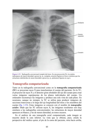 Figura 1-31 Radiografía convencional (simple) del tórax. En esta proyección PA, los tejidos
radioopacos de mayor densidad o grosor (p. ej., escápula, corazón) figuran en blanco mientras que las
estructuras radiolúcidas de menor densidad o grosor (p. ej., pulmones) figuran en negro.
Tomografía computarizada
Tanto en la radiografía convencional como en la tomografía computarizada
(TC) se proyectan rayos X para transiluminar el cuerpo del paciente. En la TC,
el proyector de rayos X y el detector giran alrededor del eje del cuerpo para crear
varias imágenes superpuestas de los planos individuales del cuerpo. Un
ordenador reconstruye las imágenes y produce una sola vista de cada plano. En
ocasiones, aunque no siempre, la TC se utiliza para producir imágenes de
secciones transversas a lo largo del eje longitudinal del tórax o los miembros del
cuerpo (fig. 1-33). Estas imágenes se conocen con el nombre de tomografías
axiales. Dado que las TC utilizan rayos X, las imágenes resultantes son muy
similares a las radiografías convencionales: las estructuras de mayor densidad
aparecen en blanco; y las de menos densidad, en tonos oscuros.
En el análisis de una tomografía axial computarizada, cada imagen se
muestra desde la cara inferior. La vista que se obtiene, pues, emula la
perspectiva del médico quien, al pie de la cama del paciente, mira hacia arriba,
85
 