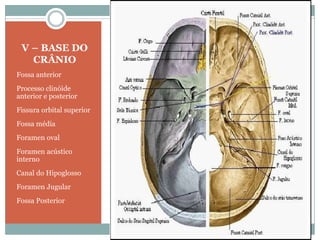 V – BASE DO
   CRÂNIO
Fossa anterior
Processo clinóide
anterior e posterior
Fissura orbital superior
Fossa média
Foramen oval
Foramen acústico
interno
Canal do Hipoglosso
Foramen Jugular
Fossa Posterior
 