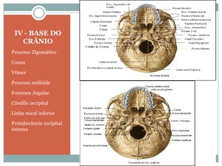 IV - BASE DO
   CRÂNIO
Processo Zigomático

Coana

Vômer

Processo estilóide

Foramen Jugular

Côndilo occipital

Linha nucal inferior

Protuberância occipital
externa
 