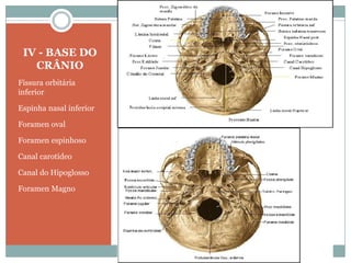 IV - BASE DO
   CRÂNIO
Fissura orbitária
inferior

Espinha nasal inferior

Foramen oval

Foramen espinhoso

Canal carotídeo

Canal do Hipoglosso

Foramen Magno
 