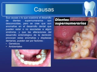 Dientes supernumerarios | PPTX