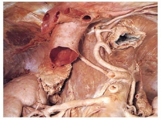 RETROPERITÔNIO –VASOS
ABDOMINAIS
 