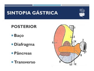 SINTOPIA GÁSTRICA
POSTERIOR
 Baço
 Diafragma
 Pâncreas
 Transverso
 
