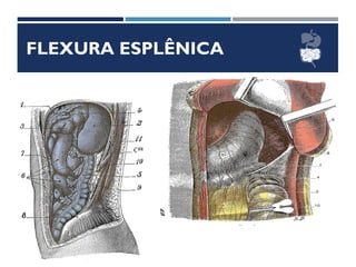FLEXURA ESPLÊNICA
 