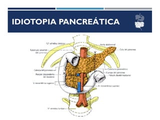 IDIOTOPIA PANCREÁTICA
 