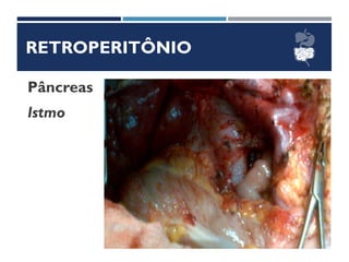RETROPERITÔNIO
Pâncreas
Istmo
 