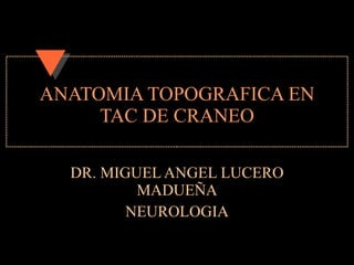 ANATOMIA TOPOGRAFICA EN TAC DE CRANEO DR. MIGUEL ANGEL LUCERO MADUEÑA NEUROLOGIA 