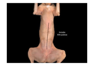 Incisão
Xifo-púbica
 
