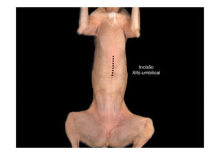 Incisão
Xifo-umbilical
 