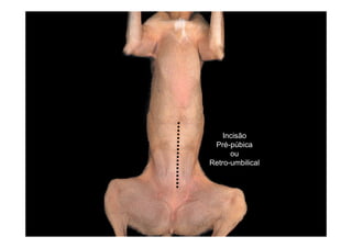 Incisão
 Pré-púbica
      ou
Retro-umbilical
 