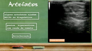 Artefatos
Cristais de Colóide
alguns artefatos ajudam
MUITO no diagnóstico
pontos hiperecóicos
com cauda de cometa
Reverberação
 