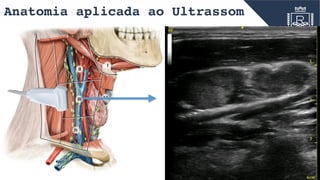 Anatomia aplicada ao Ultrassom
IV
V
III VI
I
II
 