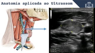 Anatomia aplicada ao Ultrassom
IV
V
III VI
I
II
 