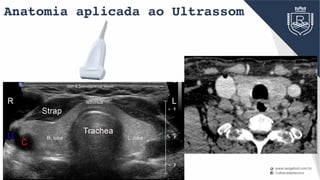 Anatomia aplicada ao Ultrassom
Head & Neck Anatomy
 