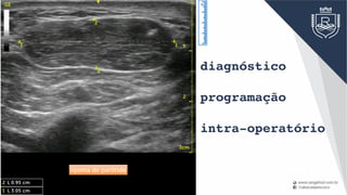 lipoma de parótida
diagnóstico
programação
intra-operatório
 