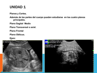 UNIDAD 1
Planos y Cortes.
Además de las partes del cuerpo pueden estudiarse en los cuatro planos
   principales.
Plano Sagital Medio
Plano Transversal o axial.
Plano Frontal
Plano Oblicuo.
Ejem:
 
