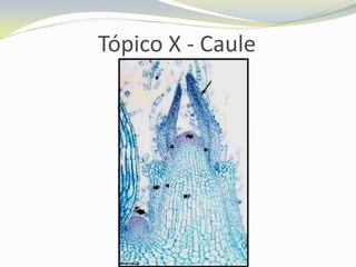 Tópico X - Caule

 