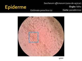 Saccharumofficinarum(cana-de-açúcar) 
Órgão:folha 
Corte:paradérmico 
Estômato paracítico(1) 
400x  