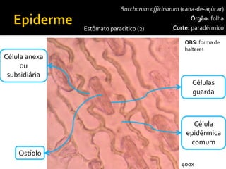Saccharumofficinarum(cana-de-açúcar) 
Órgão:folha 
Corte:paradérmico 
Células guarda 
Célula epidérmica comum 
Ostíolo 
Célula anexaou subsidiária 
Estômato paracítico(2) 
OBS: forma de halteres 
400x  