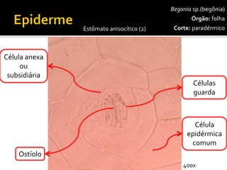 Begoniasp.(begônia) 
Órgão:folha 
Corte:paradérmico 
Células guarda 
Célula epidérmica comum 
Ostíolo 
Célula anexaou subsidiária 
Estômato anisocítico(2) 
400x  