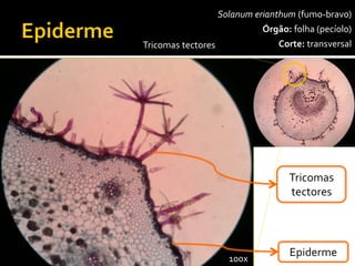Solanumerianthum(fumo-bravo) 
Órgão:folha (pecíolo) 
Corte:transversal 
Tricomastectores 
Epiderme 
Tricomastectores 
100x  