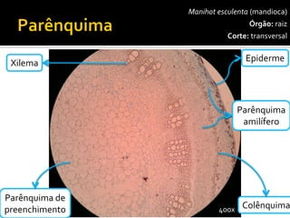 Manihotesculenta(mandioca) 
Órgão:raiz 
Corte:transversal 
Epiderme 
Parênquimaamilífero 
Xilema 
Colênquima 
400x 
Parênquimadepreenchimento  