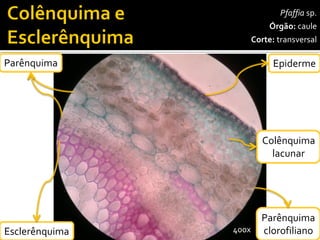 Pfaffiasp. 
Órgão:caule 
Corte:transversal 
Epiderme 
Parênquima 
Colênquima 
lacunar 
400x 
Esclerênquima 
Parênquima 
clorofiliano  