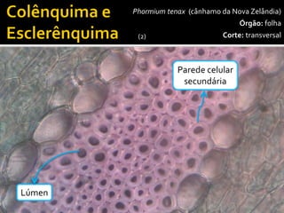 Parênquimadepreenchimento 
Phormiumtenax(cânhamo da Nova Zelândia) 
Órgão:folha 
Corte:transversal 
400x 
Esclerênquima 
FeixeVascular 
Epiderme 
Parênquimaclorofiliano 
Parênquimaaquífero 
Lúmen 
Parede celular 
secundária 
(2)  