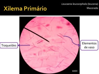 Leucaenaleucocephala(leucena) 
Macerado 
Elementos 
de vaso 
100x 
Traqueídes  
