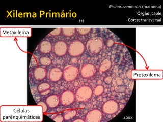 Ricinuscommunis(mamona) 
Órgão:caule 
Corte:transversal 
Protoxilema 
Metaxilema 
400x 
Células 
parênquimáticas 
(2)  