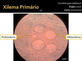 Cucurbita pepo(abóbora) 
Órgão:caule 
Corte:transversal 
Xilema 
Epiderme 
Floema 
100x 
Colênquima 
Esclerênquima 
Parênquimadepreenchimento 
400x 
Protoxilema 
Metaxilema 
(2)  