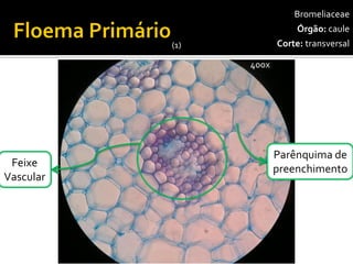 Parênquima depreenchimento 
Feixe 
Vascular 
400x 
Bromeliaceae 
Órgão:caule 
Corte:transversal 
(1)  